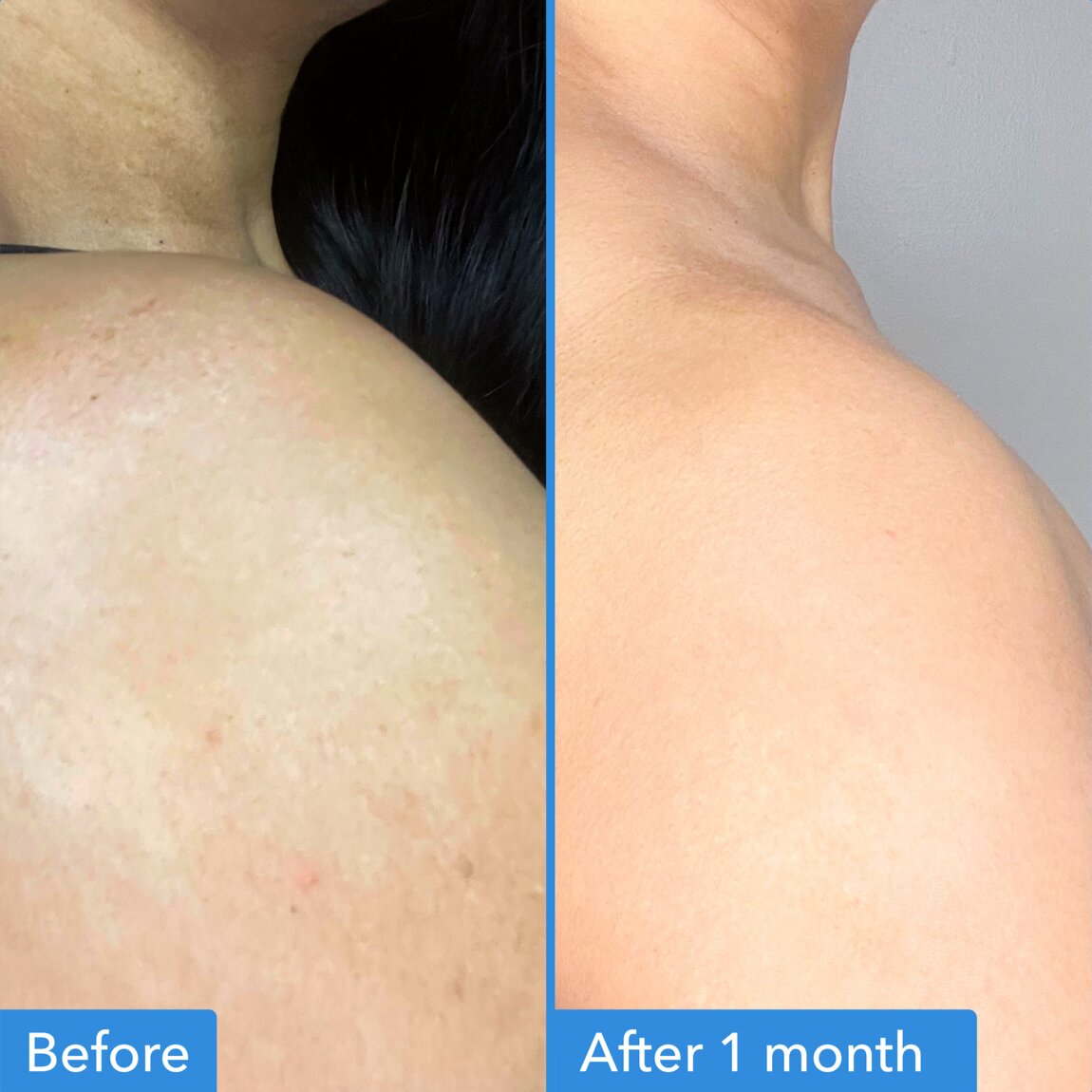 Discoloration Correcting Body Treatment R1
