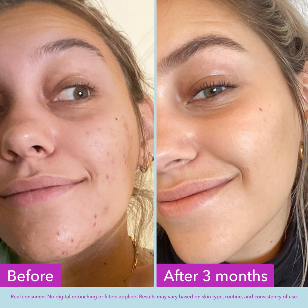 Niacinamide Brightening Toner N1