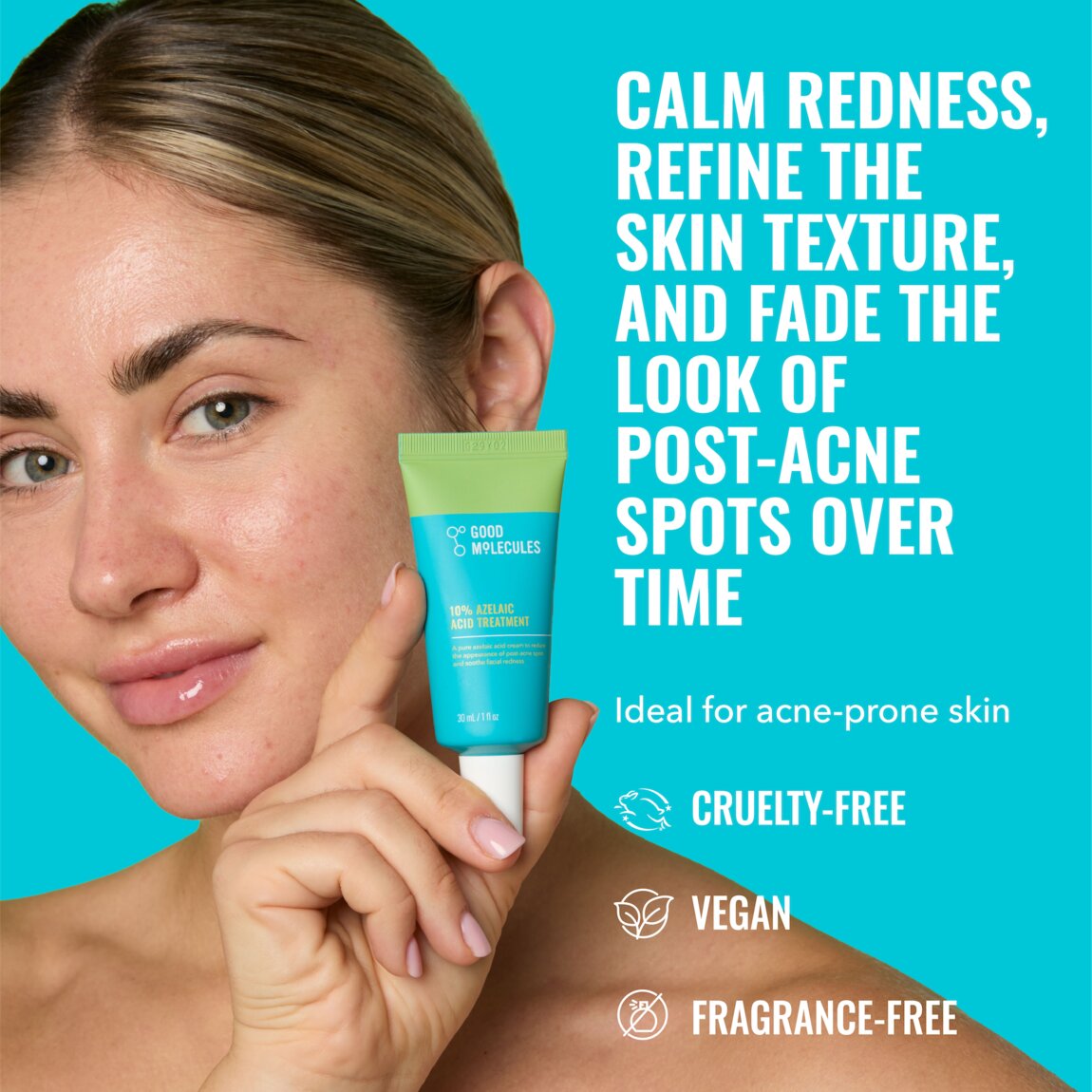 10% Azelaic Acid Treatment Y6