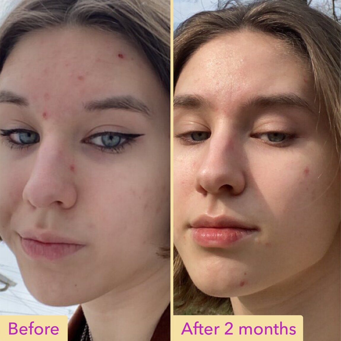 Niacinamide Serum N4