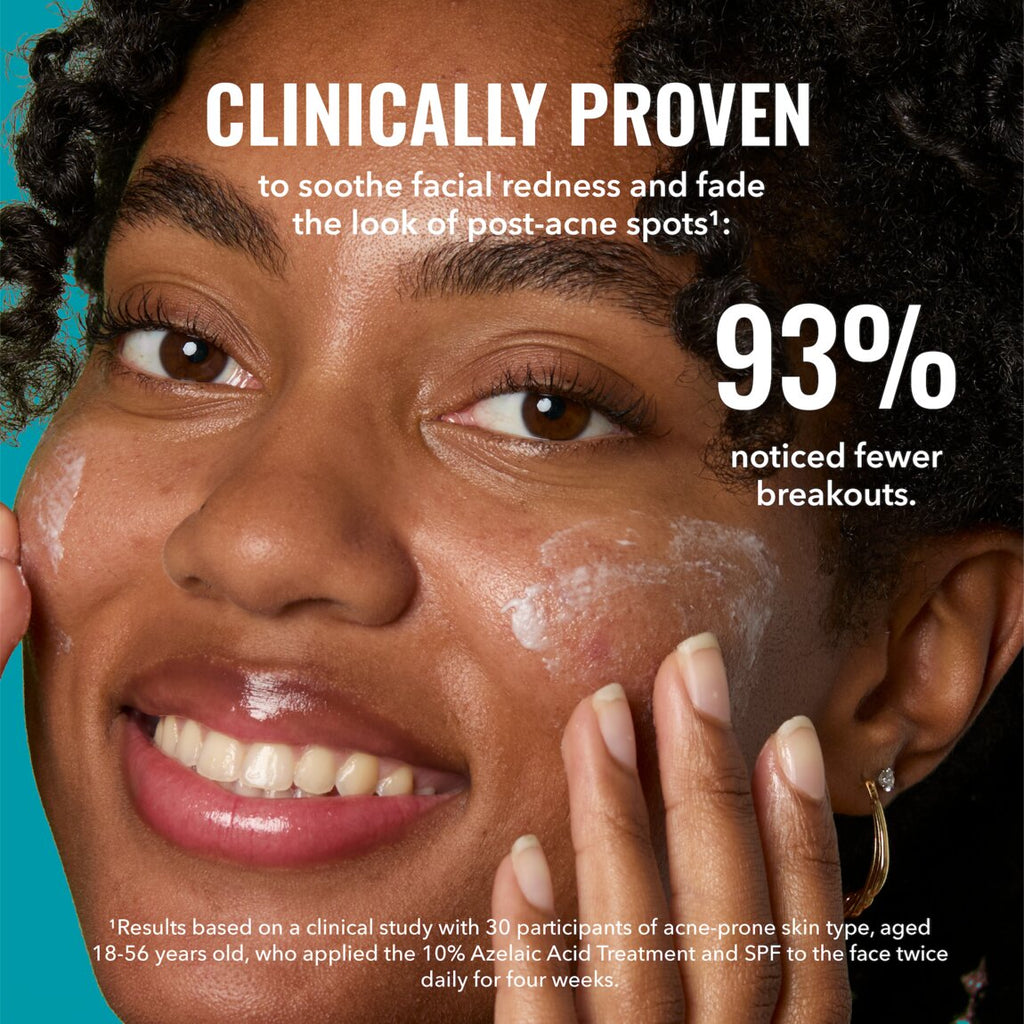 10% Azelaic Acid Treatment Y6