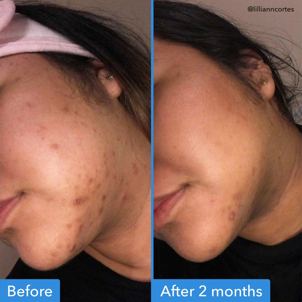 Discoloration Correcting Serum T8