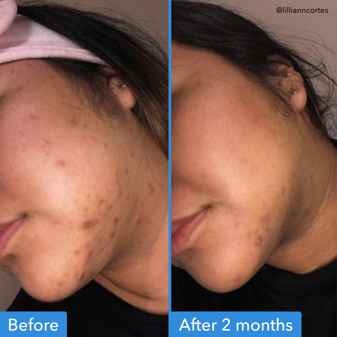 Discoloration Correcting Serum T8