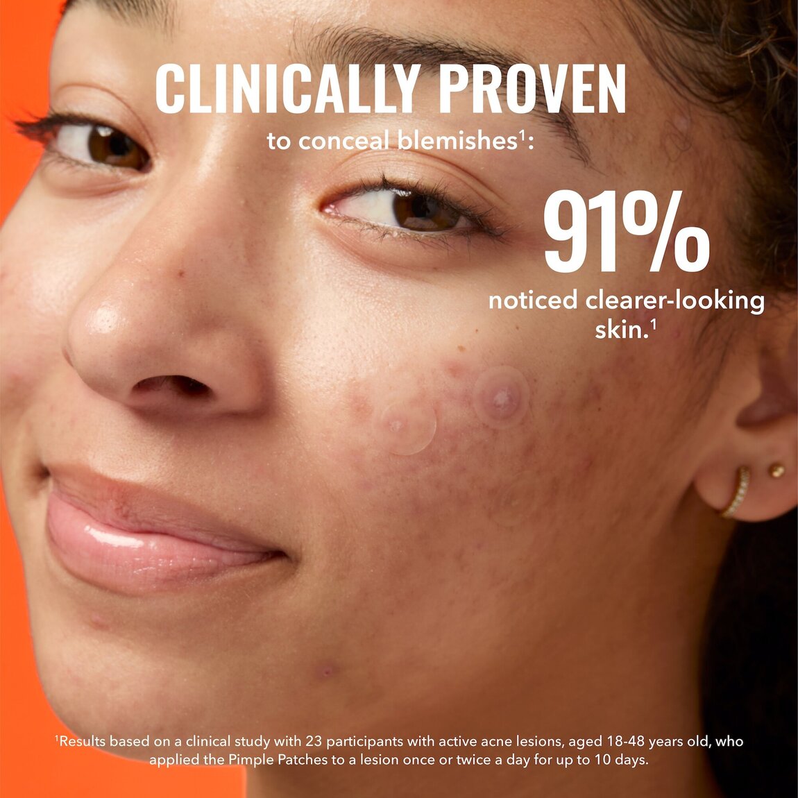 Pimple Patches T7